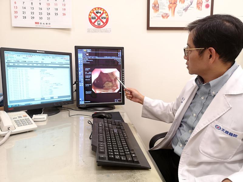 【中廣新聞網】預防大腸癌  多攝取高纖維食物及定期檢查