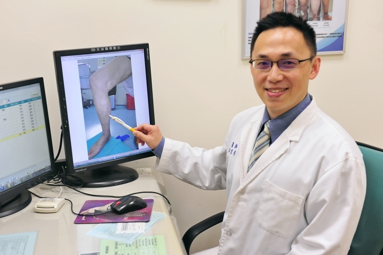 【新聞快報】林哲安醫師教您破除靜脈曲張的迷思