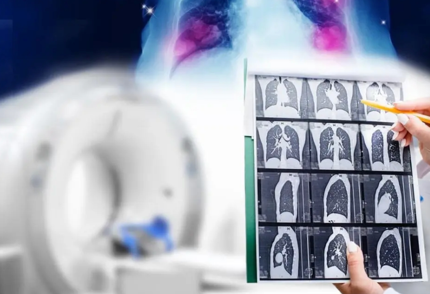 【網路溫度計】天成醫療體系肺癌篩檢救千人  提升南桃園醫療量能